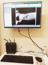 デジタルレントゲン装置FUJIFILM DR CALNEO Smart V