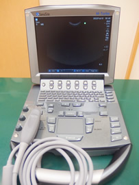 超音波診断装置