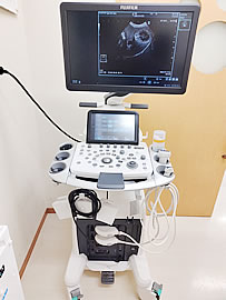 超音波診断装置